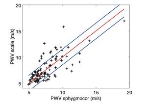 Vergleich einer medizinischen Messung der Pulswellengeschwindigkeit mit der Messung durch die Withings Body Cardio. (Quelle: Withings)